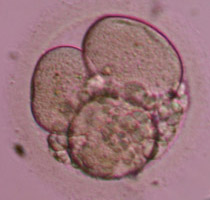 3-cell Grade II